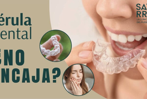 Banner Férula dental no encaja bien | Clínica Dental Satorres - Paterna - Manises