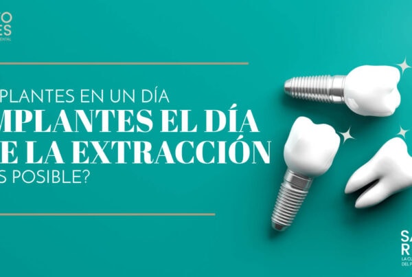 Banner Implantes el día de la extracción | Clínica Dental Satorres Paterna Manises