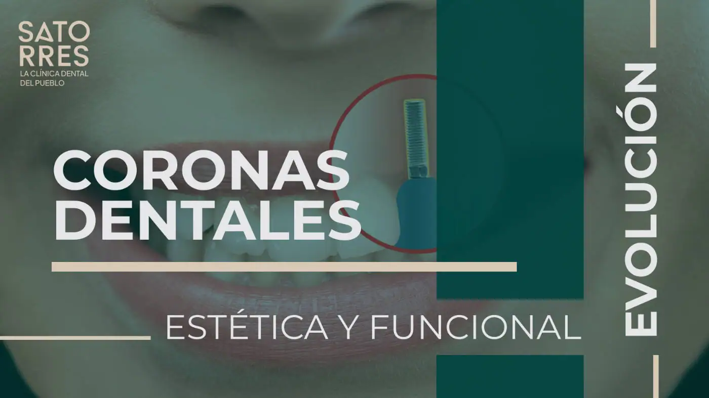 Evolución estética y funcional de las Coronas dentales