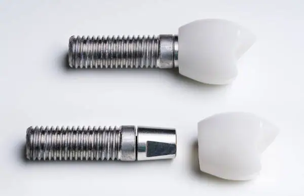 Evolución Coronas Dentales | Clínica Dental Satorres