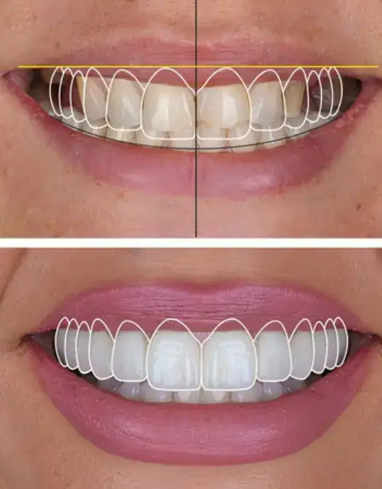 Sonrisa Digital Estéica Dental | Cínica Dental Satorres