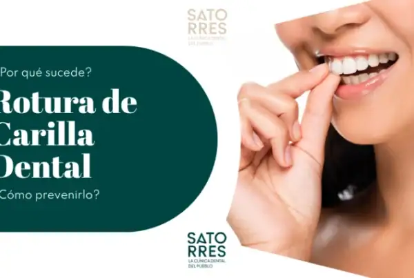 Banner Rotura de Carillas Dentales | Clínica Dental Satorres