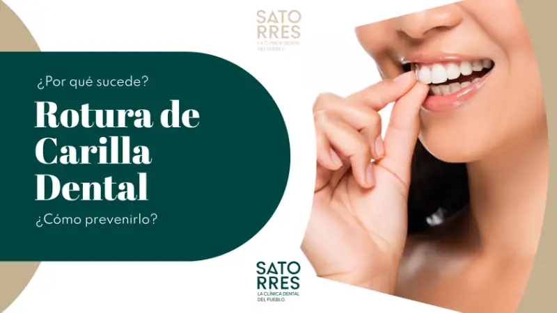 Banner Rotura de Carillas Dentales | Clínica Dental Satorres