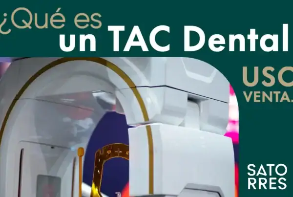 Banner que es un TAC dental | Clíncia dental Satorres Paterna Manises