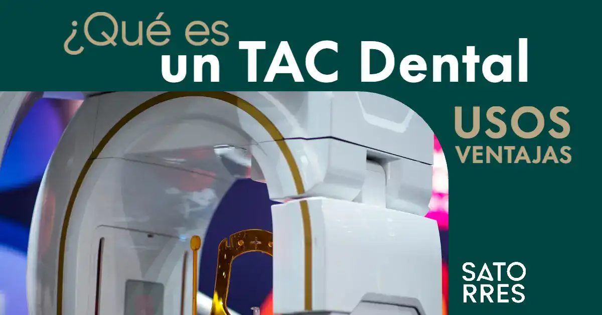 Banner que es un TAC dental | Clíncia dental Satorres Paterna Manises